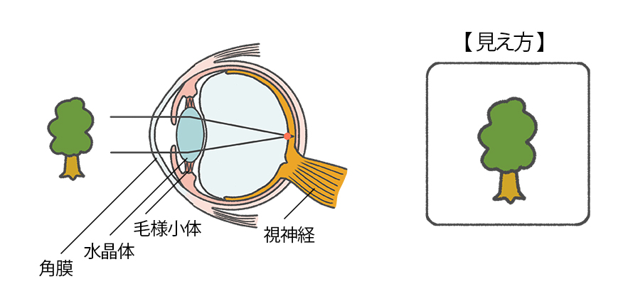 見え方